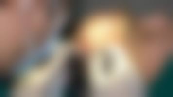 三、海口碧莲盛植发诊疗项目有哪些？