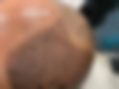 六、海口碧莲盛植发价格表