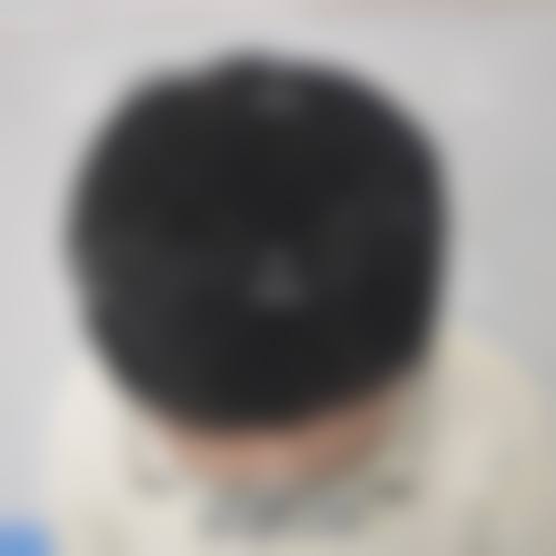 九、海口碧莲盛植发真实的患者评价