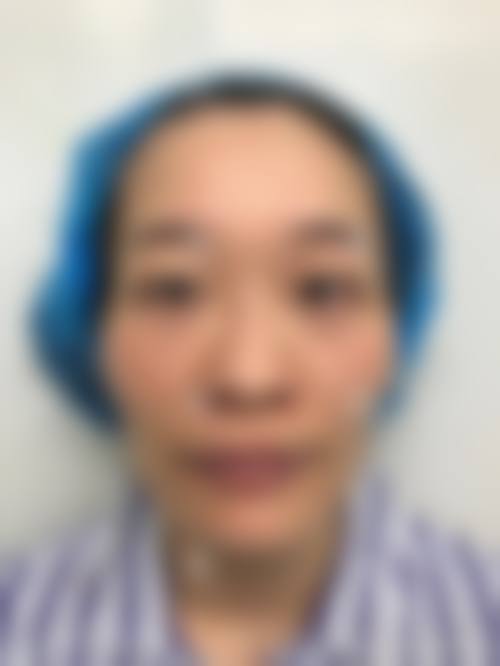 四、金华武义梦菡整形医院特色项目