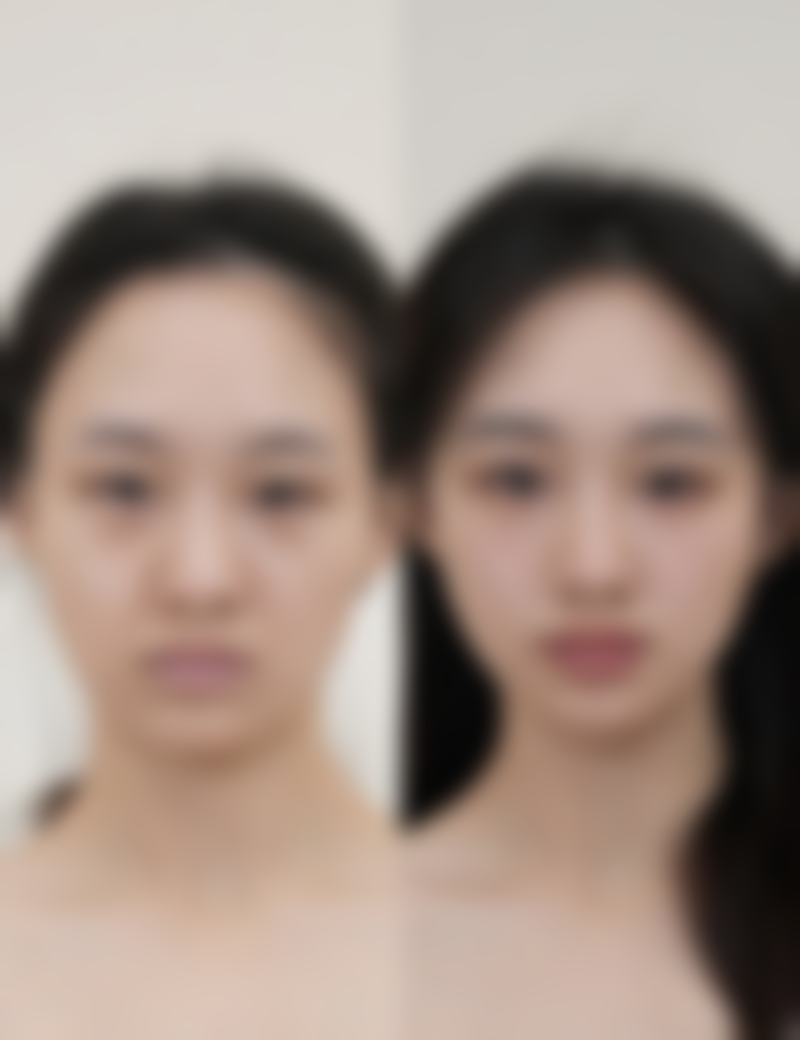 八、日常护理与预防