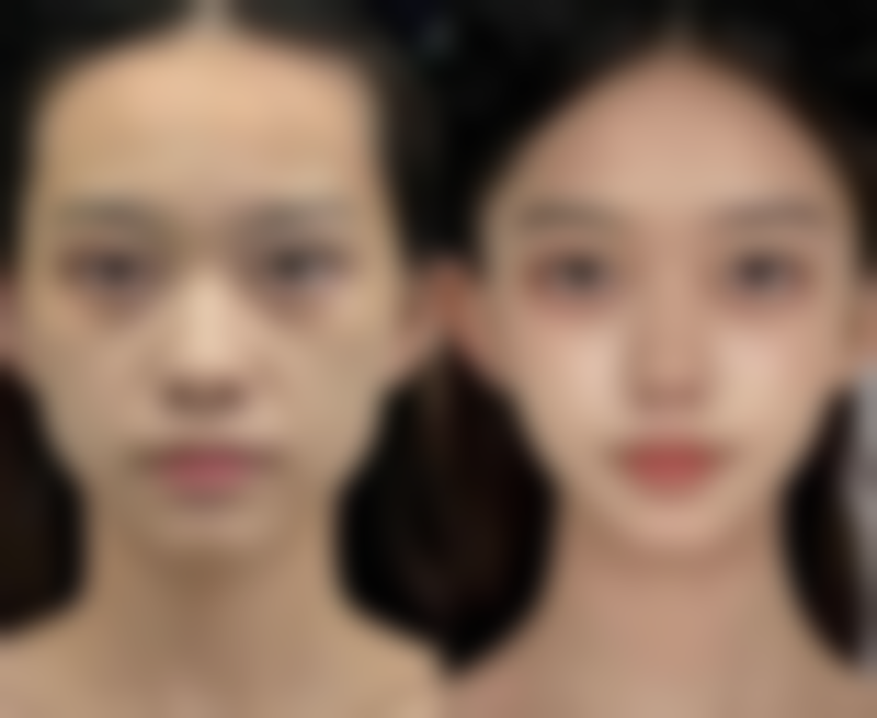 五、李光虎怎么预约?