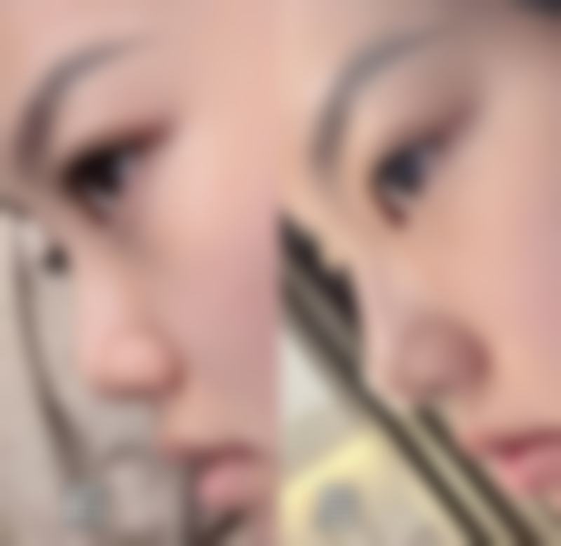 六、李光虎真实的患者评价