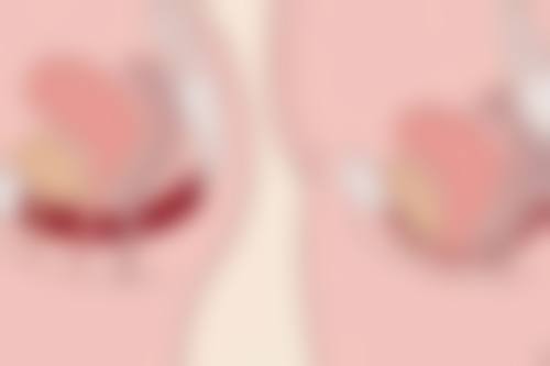 二、色素沉积引发黑眼袋是怎么引起的吗