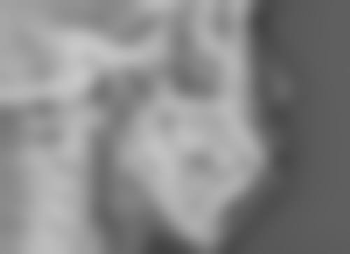 二、适合半年疤痕的祛疤膏成分分析