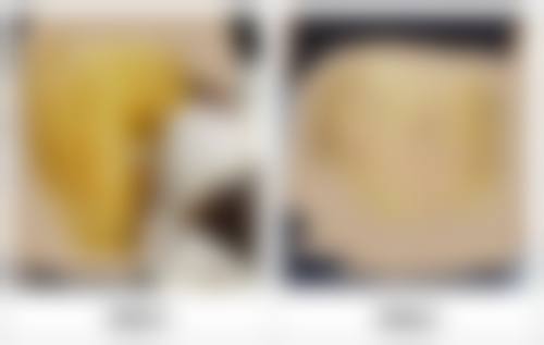 四、张鏸允收费价格表