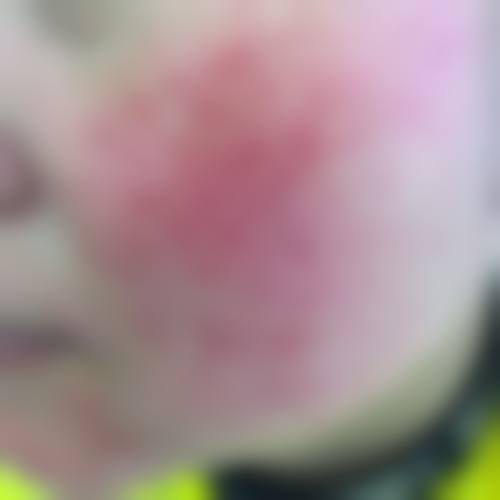 四、南京美尔嘉整形医院特色项目