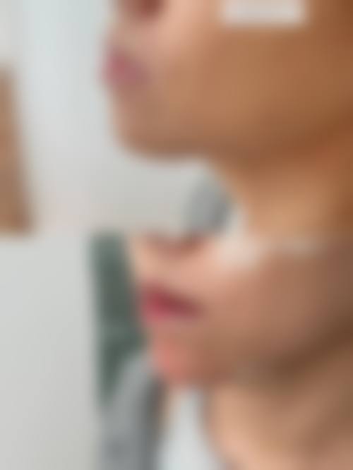 六、南京美尔嘉整形医院价格表