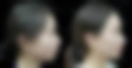 九、南京美尔嘉整形医院真实的患者评价