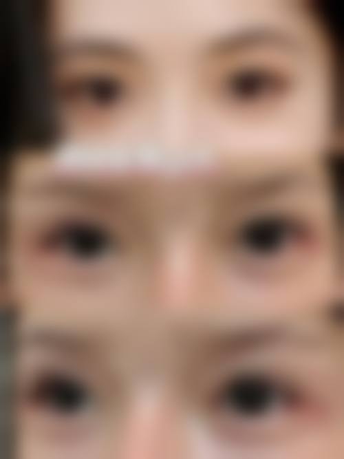 四、合肥庐阳区白厦医学美容诊所特色项目