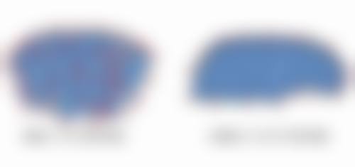 二、常见疤痕膏有效成分及适用情况