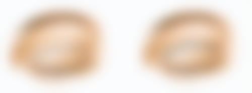 一、真的有种植头发吗？了解头发种植原理