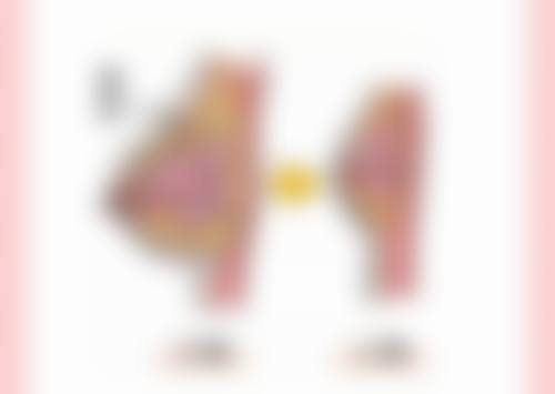 五、特殊生理阶段人群不适宜割双眼皮