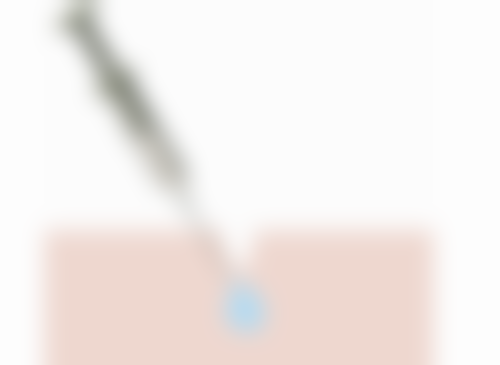 二、真的有种植头发吗？主流植发技术大揭秘