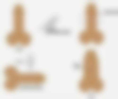 五、外切眼袋术后的其他护理要点