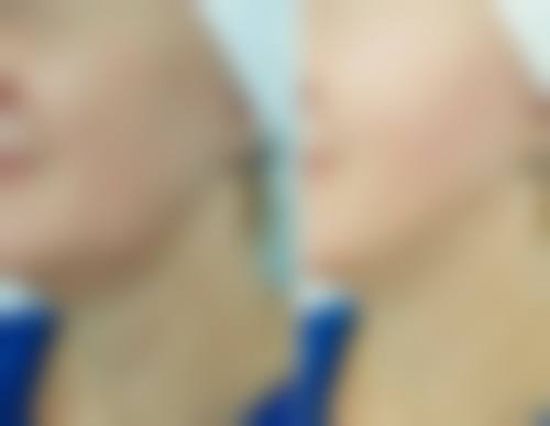 七、宁波壹肤翎医疗美容诊所预约方式