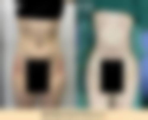 四、宁波壹肤翎医疗美容诊所特色项目