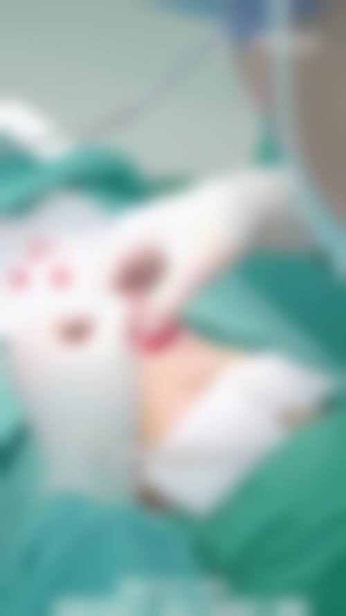 八、包头市都市整形医院真实的患者评价