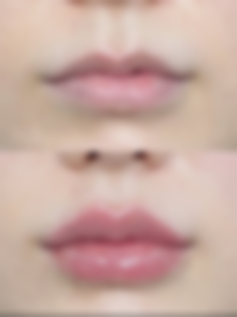 四、嘉兴龙伊医疗美容门诊部特色项目