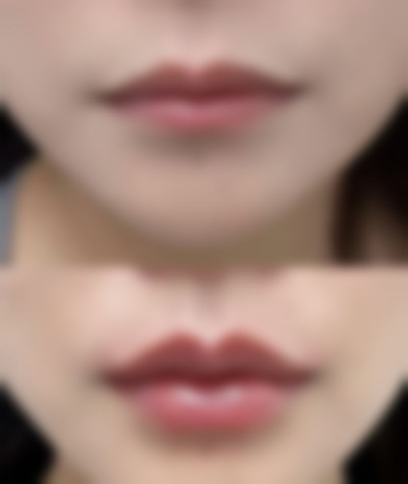 五、嘉兴龙伊医疗美容门诊部价格表