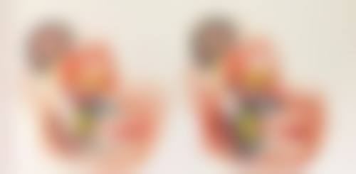 双眼皮做完会越来越窄吗？了解原因与应对方法，让你的双眼皮持久美丽 