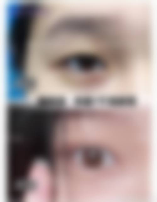 三、东莞环球美天医疗美容诊疗项目有哪些?