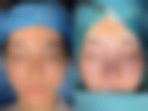 四、金华熙颜美学整形医院特色项目