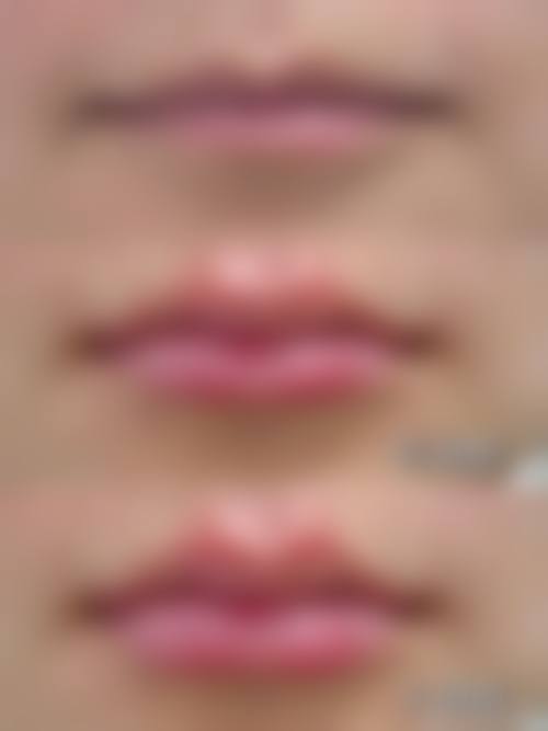 八、宁波唯爱医疗美容门诊部预约方式