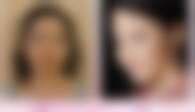 九、宁波唯爱医疗美容门诊部真实的患者评价