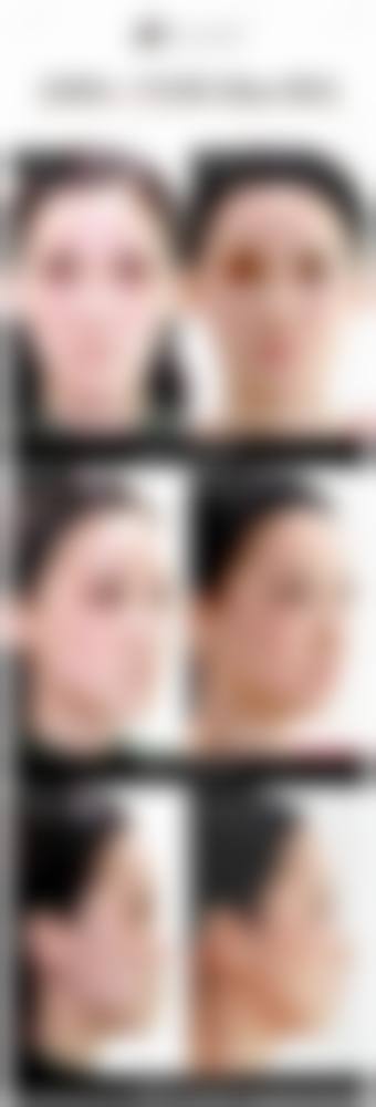 二、东莞环球美天医疗美容怎么样?