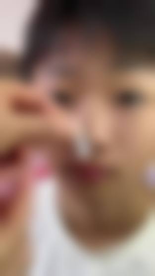 八、金华熙颜美学整形医院真实的患者评价