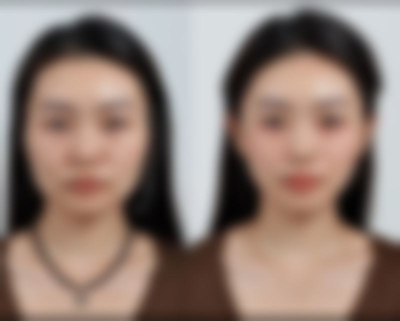 四、使用除眼袋眼霜的注意事项