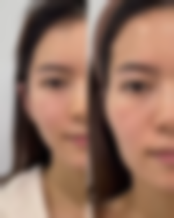 二、钱蕊擅长项目