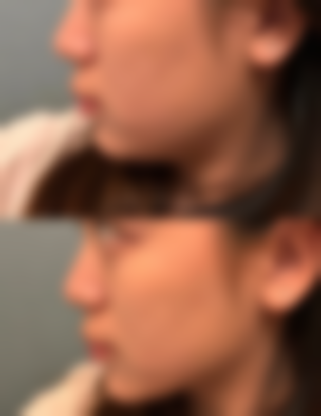 六、钱蕊真实的患者评价