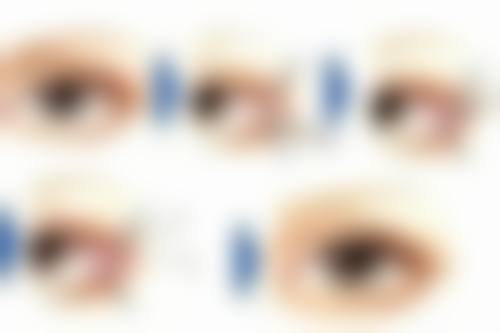 二、隆胸能给小孩喂奶吗？手术切口位置特别关键