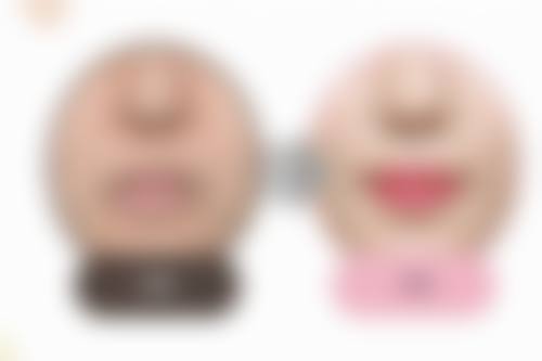 四、隆胸能给小孩喂奶吗？做好这些准备特别重要