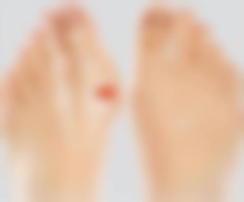 四、阴道紧缩术潜在风险预防方法