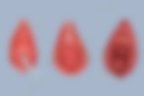 三、割了双眼皮祛疤膏的选择和使用方法