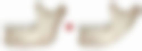 阴道紧缩对身体有害吗？了解潜在危害及预防方法保障手术安全有效 