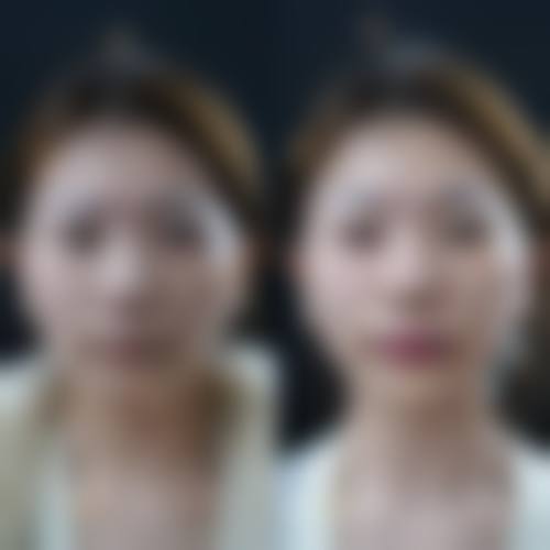 五、韩国onul整形外科价格表