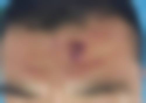 五、龙口壹美天成医疗美容医院价格表