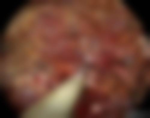 八、龙口壹美天成医疗美容医院真实的患者评价