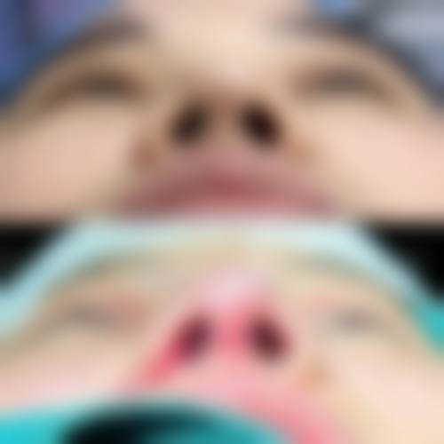 三、杭州曼悦美整形医院诊疗项目有哪些?