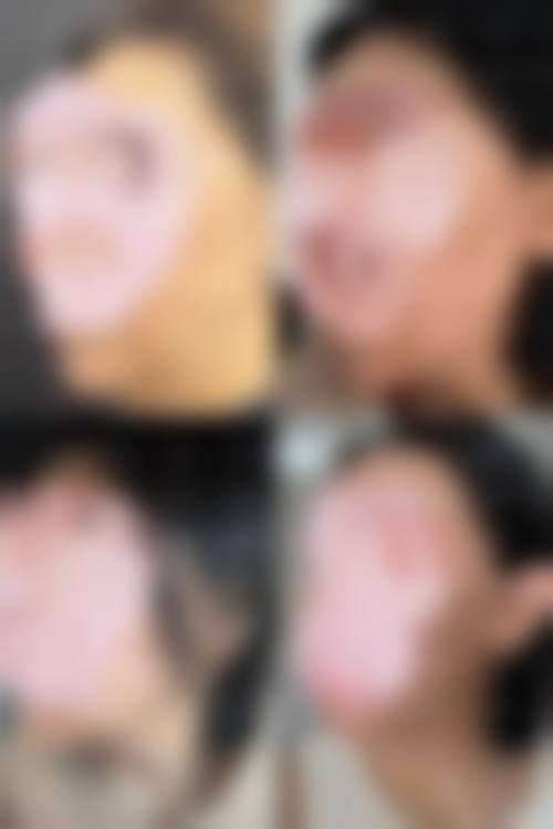 四、杭州曼悦美整形医院特色项目