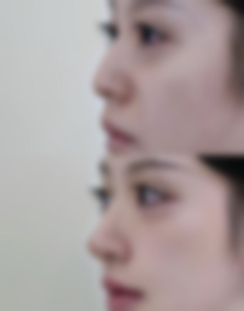 三、其他可能影响反弹的因素