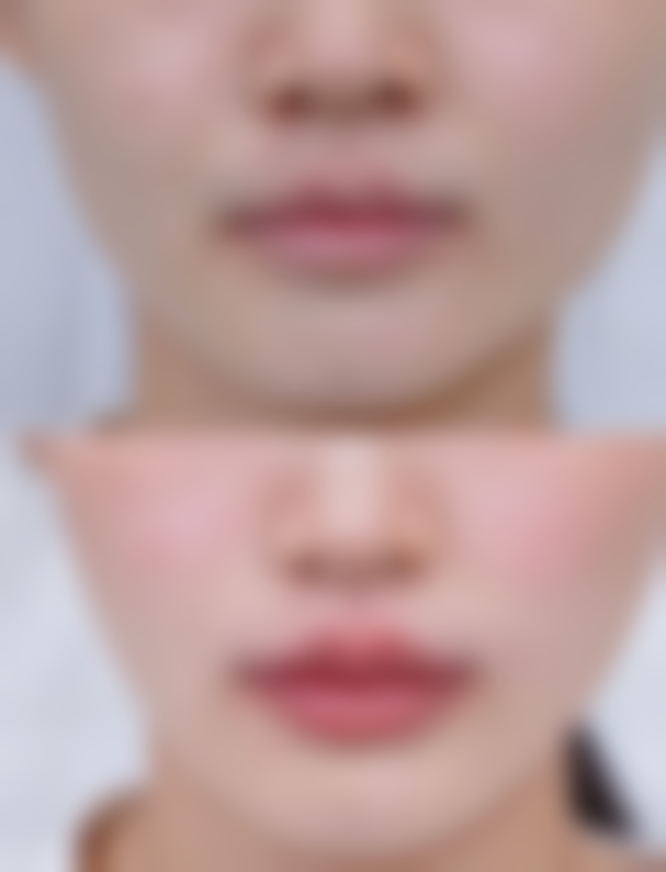 五、杭州曼悦美整形医院价格表