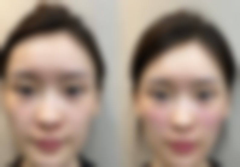 二、彭华伟医生简介