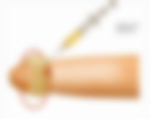 瘦脸针80单位够打两边吗？总结与建议