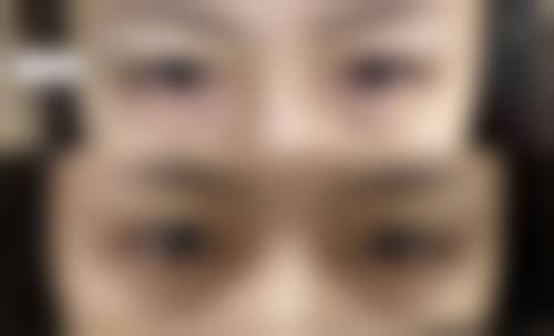 六、周亚萍真实的患者评价