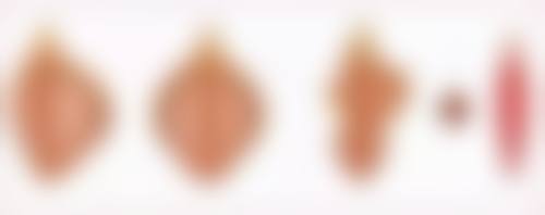 一、红色疤痕形成的原因